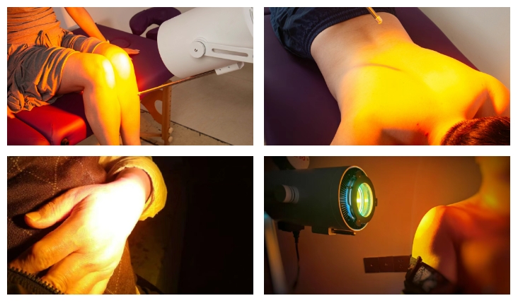 高能红外光热仪患者体验